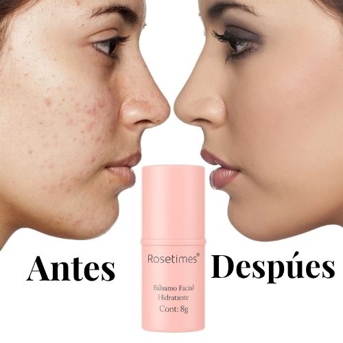 RoseGlow™  Bálsamo Facial Hidratante Antiarrugas.