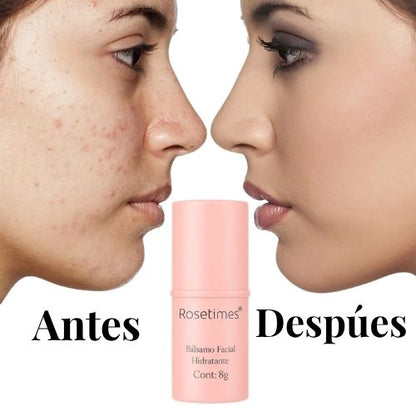 RoseGlow™  Bálsamo Facial Hidratante Antiarrugas.