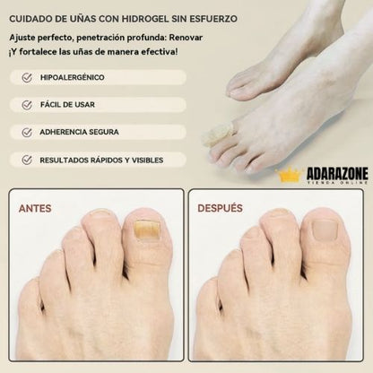 Parche Nocturno para Uñas Dañadas .