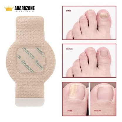 Parche Nocturno para Uñas Dañadas .