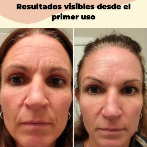 DermaLuxe Parches™ – Hidrata líneas de en Minutos.