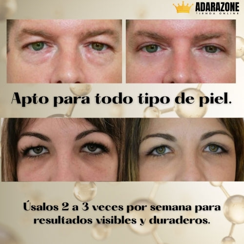 LumiLift Parches™ –  Parches Rejuvenecedores.