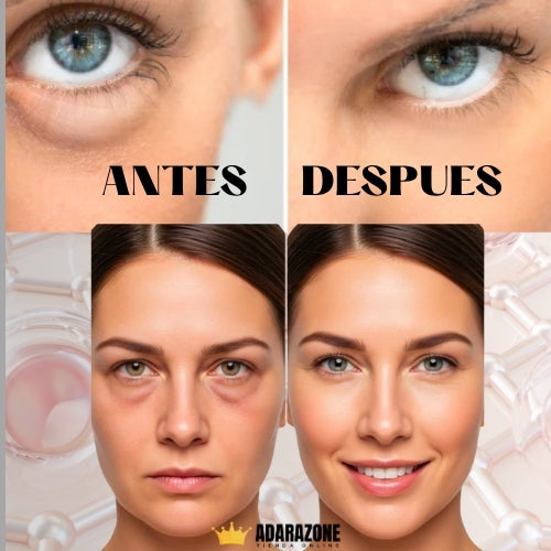 LumiLift Parches™ –  Parches Rejuvenecedores.